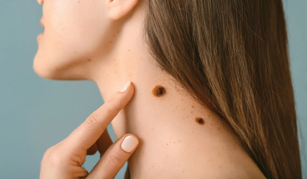 That Lump, Cyst or Skin Tag? Get It Sorted This Week — No NHS Wait